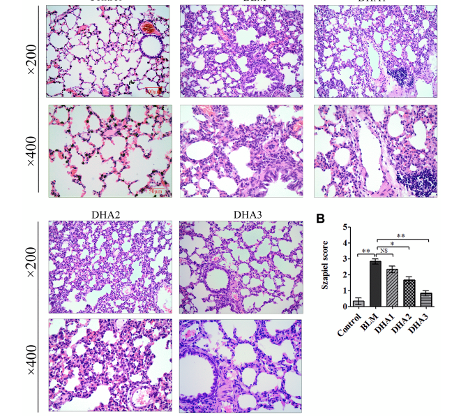 Dihydroartemisinin attenuates pulmonary inflammation and fibrosis in rats by suppressing JAK2/STAT3 signaling