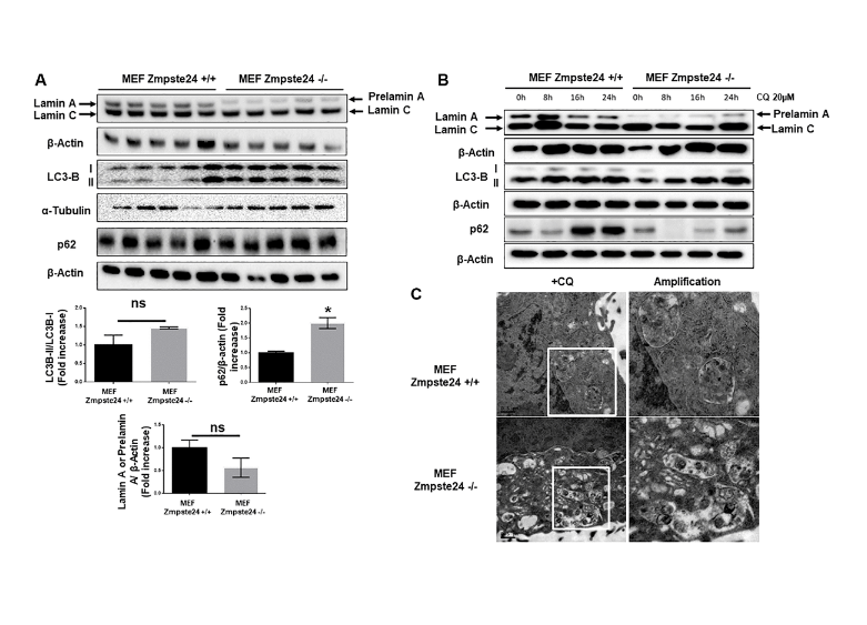Cell immortalization facilitates prelamin A clearance by increasing both cell proliferation and autophagic flux
