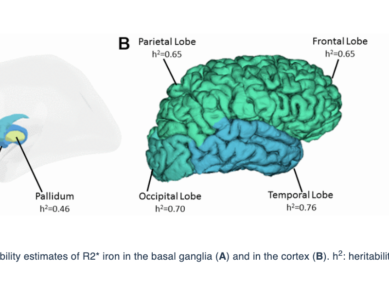 Figure 1. Heritability estimates of R2* iron in the basal ganglia (A) and in the cortex (B). h2: heritability.