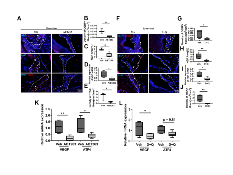 Senolytic drugs relieve pain by reducing peripheral nociceptive signaling without modifying joint tissue damage in spontaneous osteoarthritis