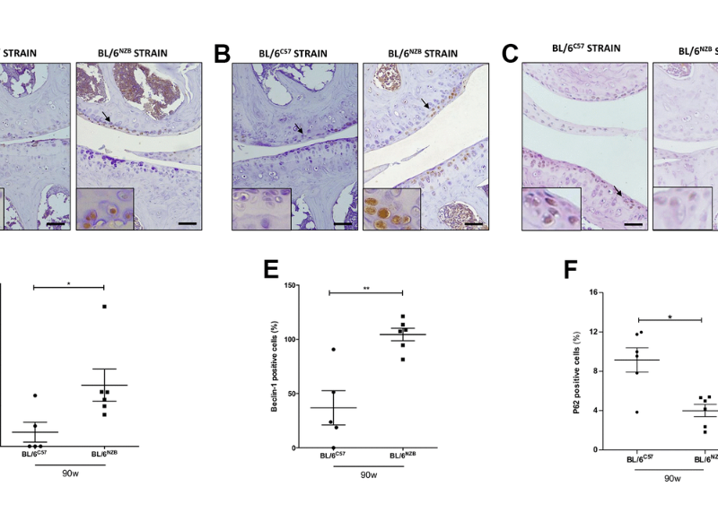 mtDNA variability determines spontaneous joint aging damage in a conplastic mouse model