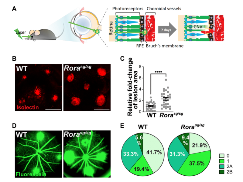 Figure 2. Genetic deficiency of RORα increased lesion size and vascular leakage in a mouse model of laser-induced choroidal neovascularization (CNV).