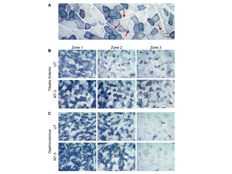 Figure 2. Muscle fiber size increase in aged C57BL/6 mice with AAV1.NT-3 gene therapy.