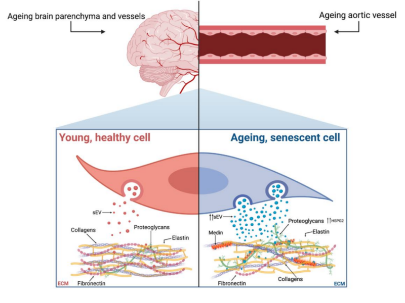 Figure 1. Proposed mechanism showing the parallels between age-associated brain and vascular amyloidosis, with both being mediated by sEVs and affected by cellular senescence.