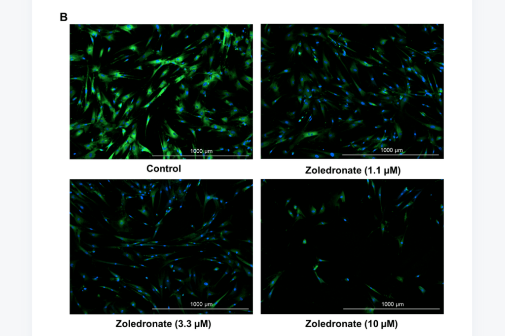 Figure 1. Zoledronic acid has senolytic effects in human lung fibroblast IMR90 cells.