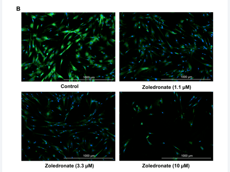 Figure 1. Zoledronic acid has senolytic effects in human lung fibroblast IMR90 cells.