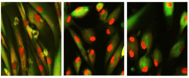 Image 2. Rejuvenation and age reversal of senescent human skin cells by chemical means. Cells in the right two panels have restored compartmentalization of the red fluorescent protein in the nucleus, a marker of youth that was used to find the cocktails, before the scientists confirmed they were younger, based on how genes were expressed. Image credit: J. -H. Yang, Harvard Medical School.