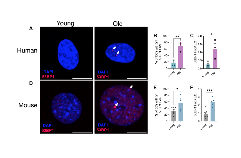 Reduction of double-strand DNA break repair exacerbates vascular aging