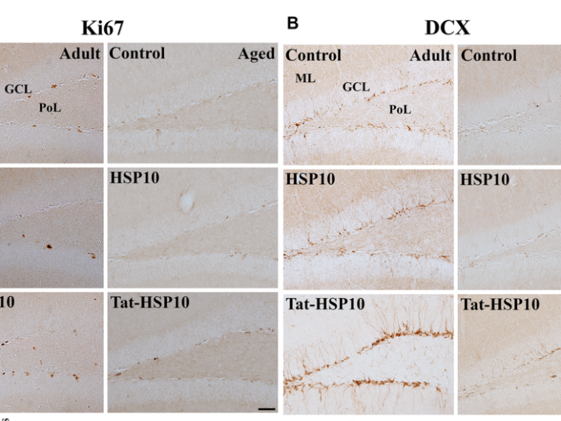 Figure 3. Effects of Tat-HSP10 and HSP10 on cell proliferation and neuroblast differentiation in adult and aged mice.