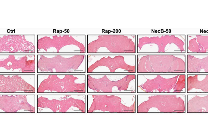 Figure 5. NecB inhibited age-related neurodegeneration in D. melanogaster’s brain morphology.