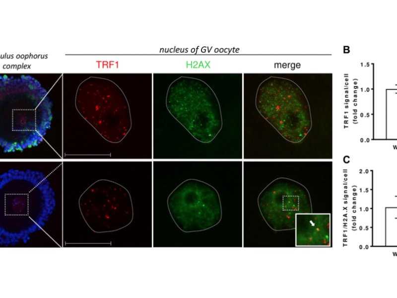 Figure 6. Representative confocal images of TRF1 expression and TRF/H2AX co-localization in cumulus oophorus isolated from 6-month-old wild-type and Clpp−/− mice.