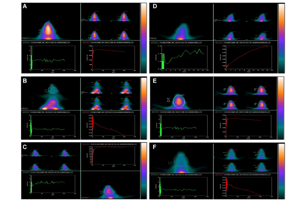 Figure 9. Effect of GNL on D-gal-induced cognitive impairment mice by using 99mTc-HMPAO (brain) animal imaging. 
