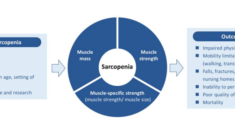 Global consensus for sarcopenia