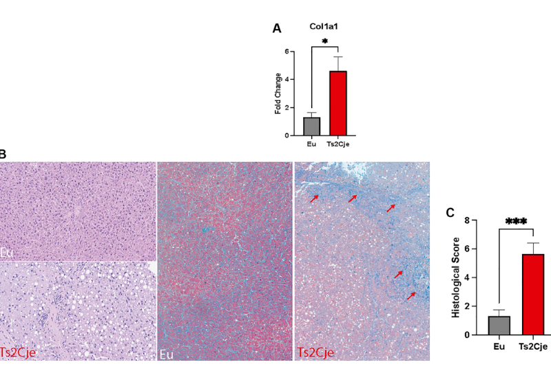 Aging Exacerbates Oxidative Stress and Liver Fibrosis in an Animal Model of Down Syndrome