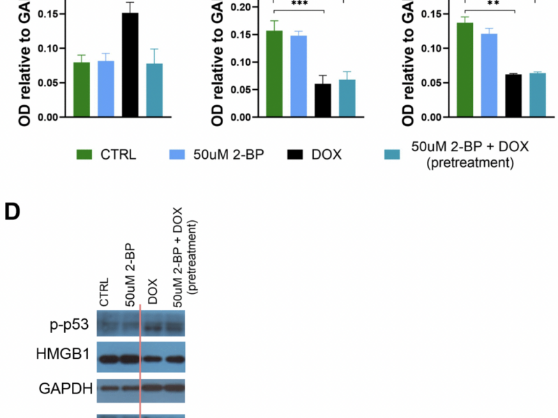 2-Bromopalmitate treatment attenuates senescence phenotype in human adult cells - possible role of palmitoylation