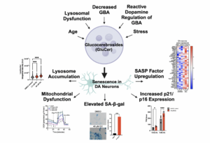Lipid Accumulation Drives Cellular Senescence in Dopaminergic Neurons