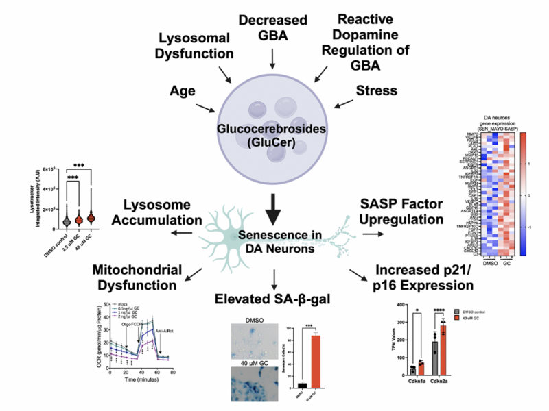 Lipid Accumulation Drives Cellular Senescence in Dopaminergic Neurons