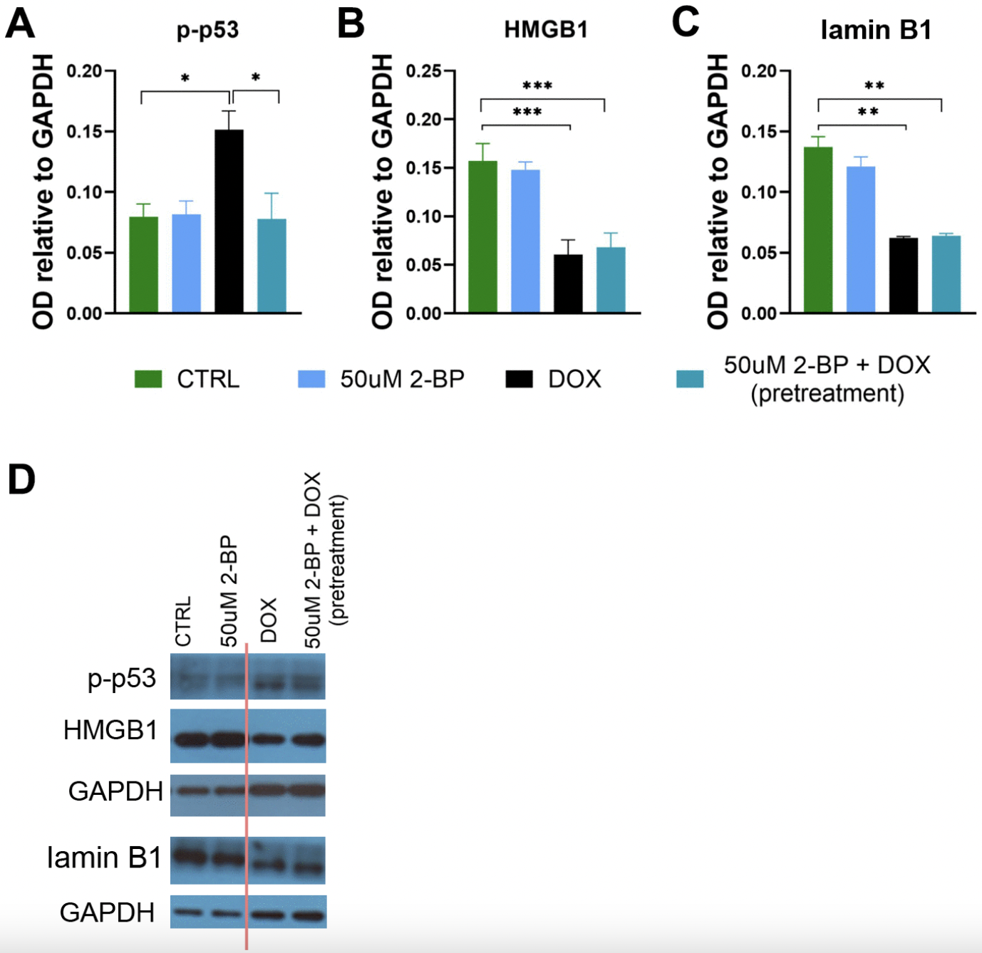 2-Bromopalmitate Reduces Senescence in Human Cells: Role of Palmitoylation