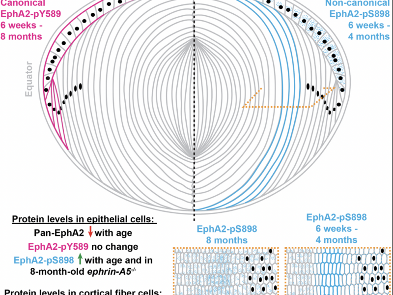 EphA2 Signaling in Eye Lens Aging: Wild-Type, Knockout, and Aging Mice