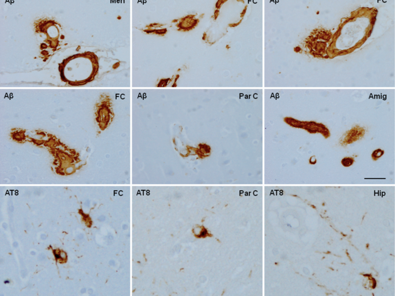 Brain Aging and Alzheimer’s: Insights from Non-Human Primates