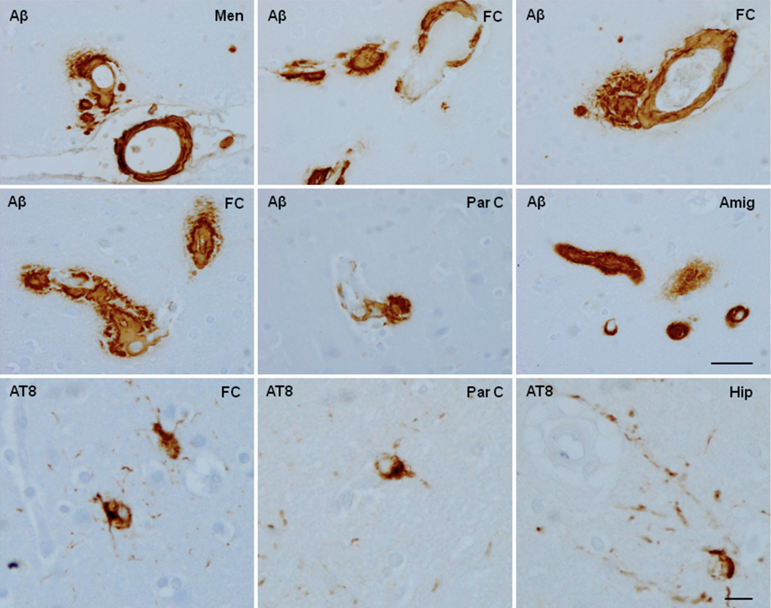 Brain Aging and Alzheimer’s: Insights from Non-Human Primates