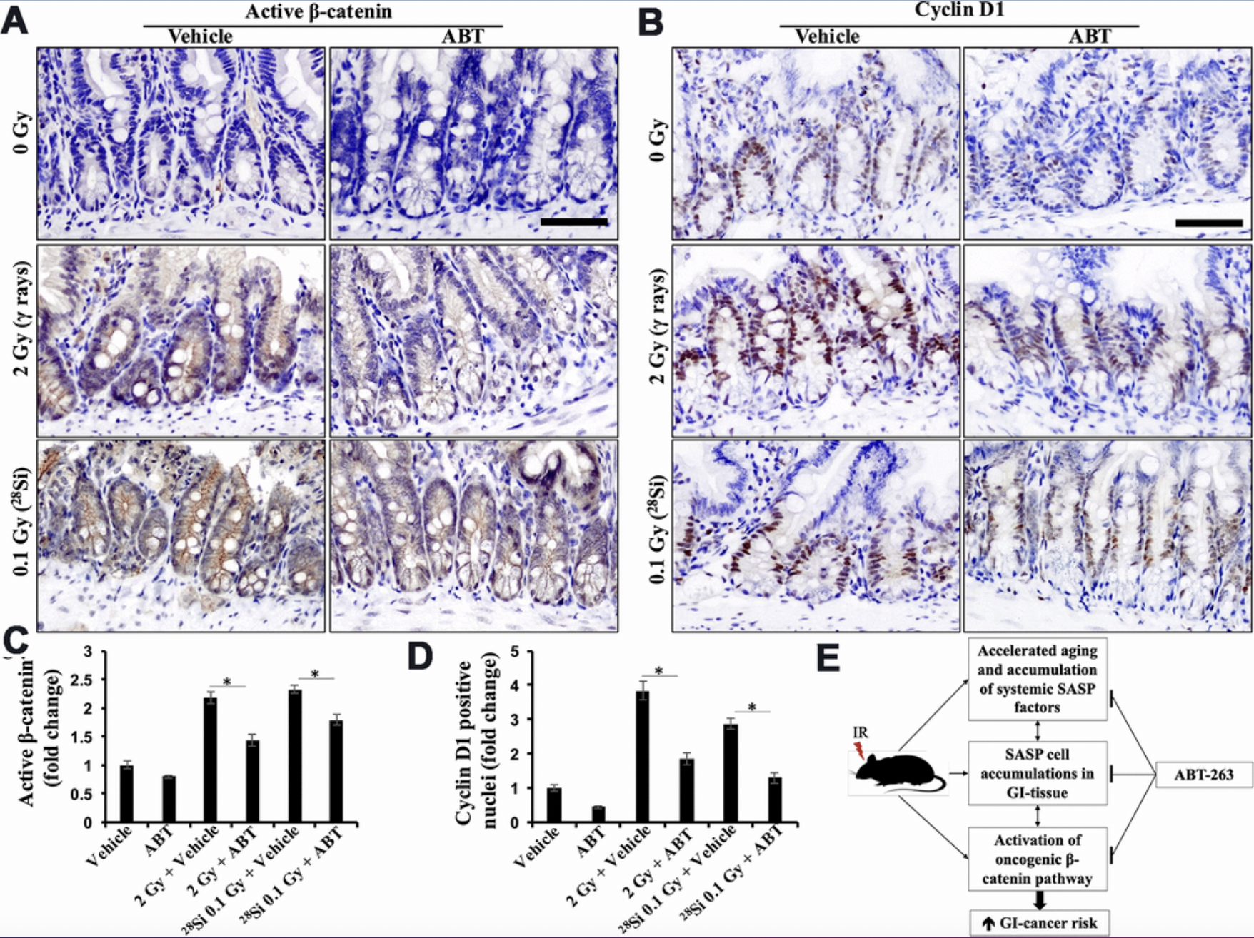 Senolytic ABT-263 Reduces Radiation-Induced Gastrointestinal Cancer