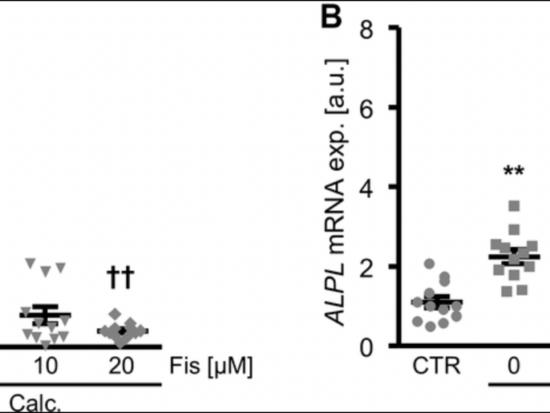 Fisetin ameliorates vascular smooth muscle cell calcification via DUSP1-dependent p38 MAPK inhibition