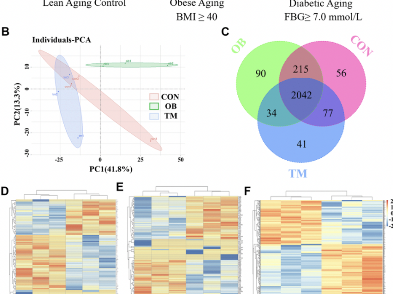 Multi-omics analysis reveals metabolic disruptions in cardiac tissues of aging nonhuman primates with spontaneous type 2 diabetes