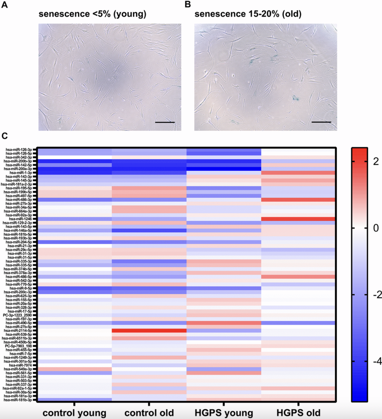Deregulated miR-145 and miR-27b in Hutchinson-Gilford progeria syndrome: implications for adipogenesis