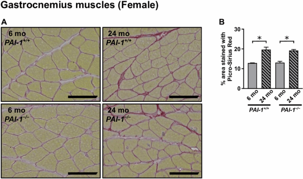 PAI-1 Deficiency Protects Aging Female Mice from Muscle and Bone Loss