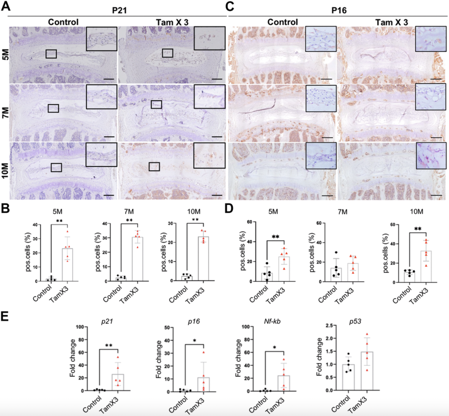 Overactive Runx1 Gene Triggers Early Disc Degeneration Linked to Aging